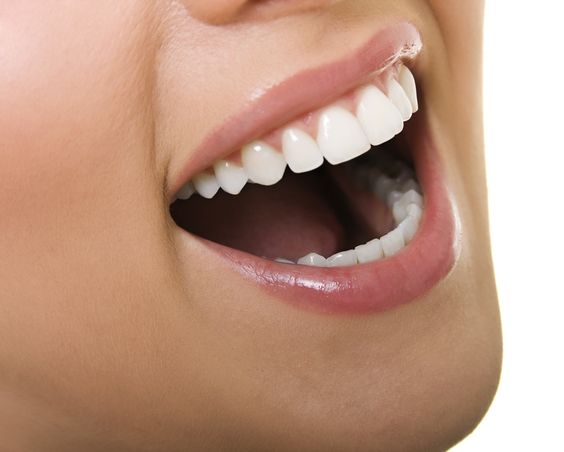 Blanqueamiento Dental ¿Hay Un Límite?